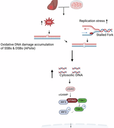 Hyperactivation of the cGAS-STING pathway promotes liver inflammation in Down syndrome