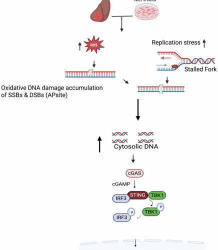 Hyperactivation of the cGAS-STING pathway promotes liver inflammation in Down syndrome