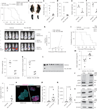 Inhibition of salt-inducible kinases reprograms T cells and antitumor immunity in ovarian cancer