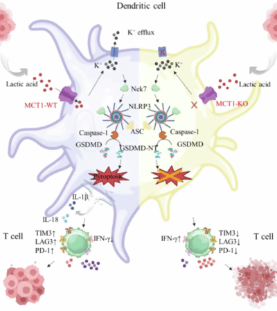 Lactic acid induces dendritic cell pyroptosis through MCT-1 to promote tumor immune evasion