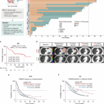 Low-dose radiotherapy synergizes with PD-1 blockade to achieve durable survival in advanced NSCLC through antitumor neutrophil programming