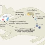 Male sex hormone loss aids brain tumour growth