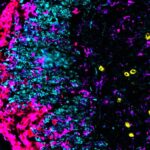 Monocyte-derived macrophages drive neurological tissue damage through mitochondrial reactive oxygen species | Science Immunology