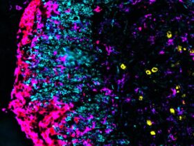 Monocyte-derived macrophages drive neurological tissue damage through mitochondrial reactive oxygen species | Science Immunology