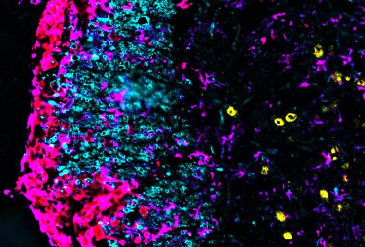 Monocyte-derived macrophages drive neurological tissue damage through mitochondrial reactive oxygen species | Science Immunology