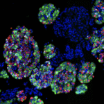 Isolated islets showing cell nuclei (blue) and three main endocrine cell types: insulin-producing beta cells (green), glucagon-producing alpha cells (red), and somatostatin-producing delta cells (white).