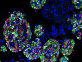 Isolated islets showing cell nuclei (blue) and three main endocrine cell types: insulin-producing beta cells (green), glucagon-producing alpha cells (red), and somatostatin-producing delta cells (white).