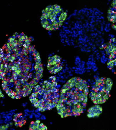 Isolated islets showing cell nuclei (blue) and three main endocrine cell types: insulin-producing beta cells (green), glucagon-producing alpha cells (red), and somatostatin-producing delta cells (white).