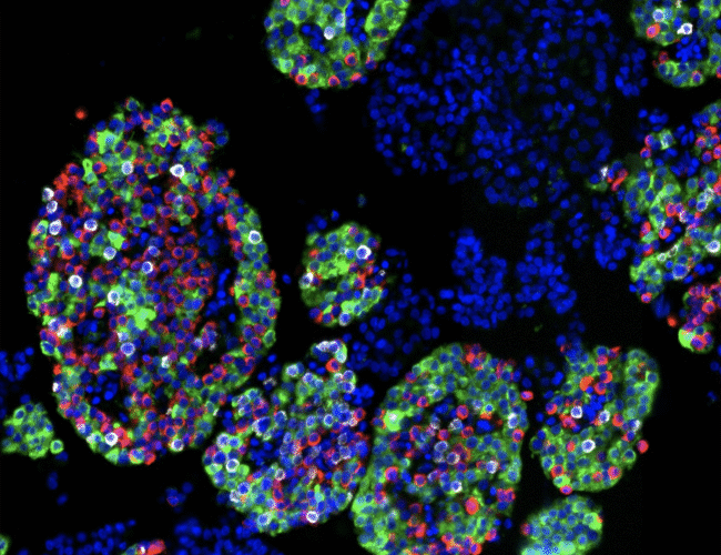 Isolated islets showing cell nuclei (blue) and three main endocrine cell types: insulin-producing beta cells (green), glucagon-producing alpha cells (red), and somatostatin-producing delta cells (white).