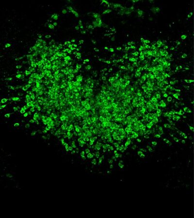 Fluorescence indicates heterogeneous calcium activity in hundreds of area postrema neurons