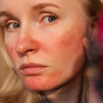 Researchers Explain What The Redness On Your Face Actually Is