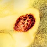 Image of a colorized transmission electron micrograph of a measles virus particle (red).