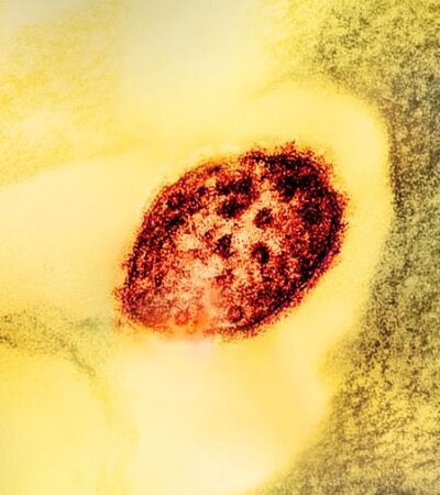 Image of a colorized transmission electron micrograph of a measles virus particle (red).