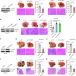 SLC38A4 promotes Kupffer cell phagocytosis and suppresses tumor liver metastasis