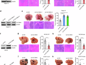 SLC38A4 promotes Kupffer cell phagocytosis and suppresses tumor liver metastasis