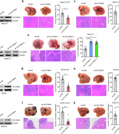 SLC38A4 promotes Kupffer cell phagocytosis and suppresses tumor liver metastasis
