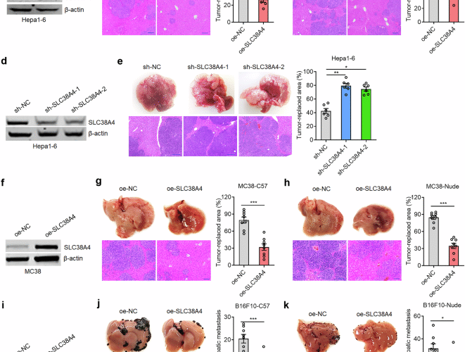 SLC38A4 promotes Kupffer cell phagocytosis and suppresses tumor liver metastasis