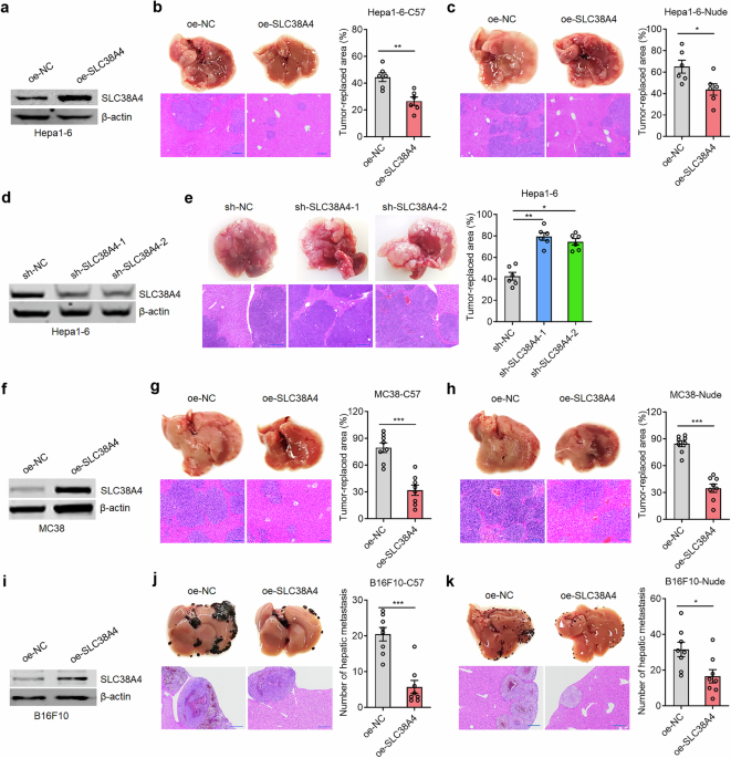 SLC38A4 promotes Kupffer cell phagocytosis and suppresses tumor liver metastasis