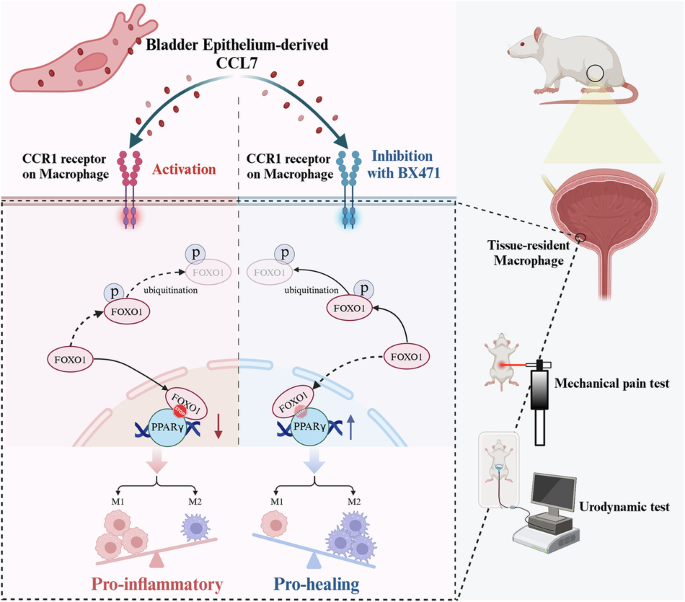 Targeting CCR1-mediated macrophage phenotypic switching to alleviate bladder pain and urinary dysfunction in interstitial cystitis