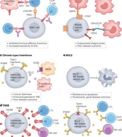 The immunology of human breast cancer